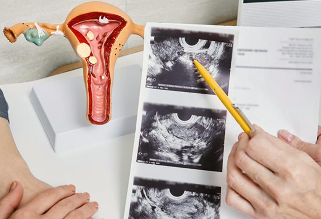 Antenatal care and pregnancy support at Reliance Hospital Rawalpindi
